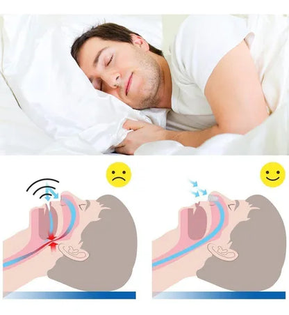 Tiras Magneticas Nasales